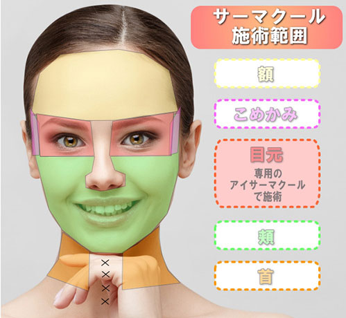 サーマクールサーマルリフトフラクショナル