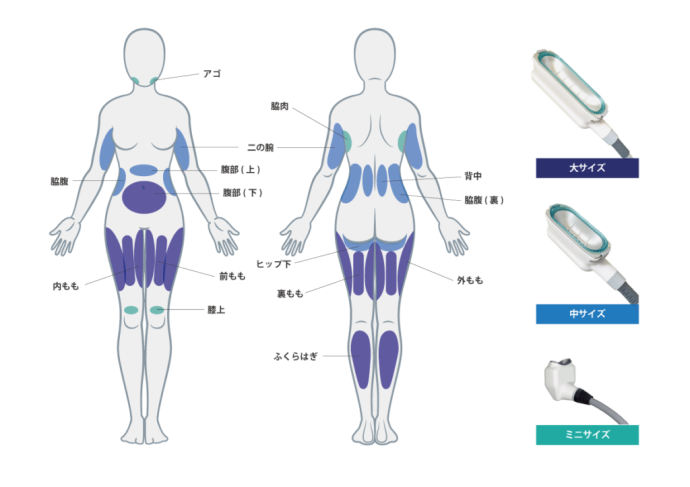360度 脂肪冷却 強いパワー 業務用 2ハンドル同時稼働 360度 脂肪冷却
