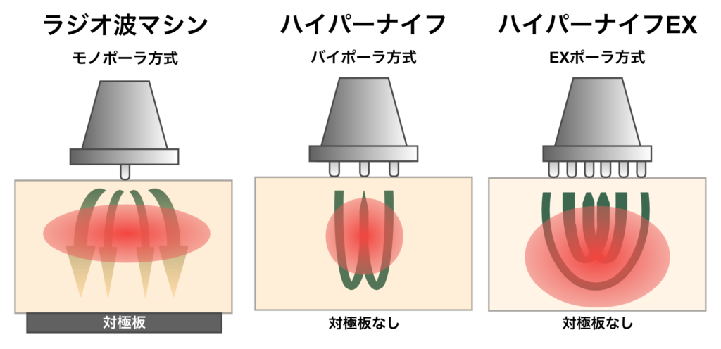 ハイパーナイフ機械の種類を徹底調査！新型ハイパーナイフEX導入で売上