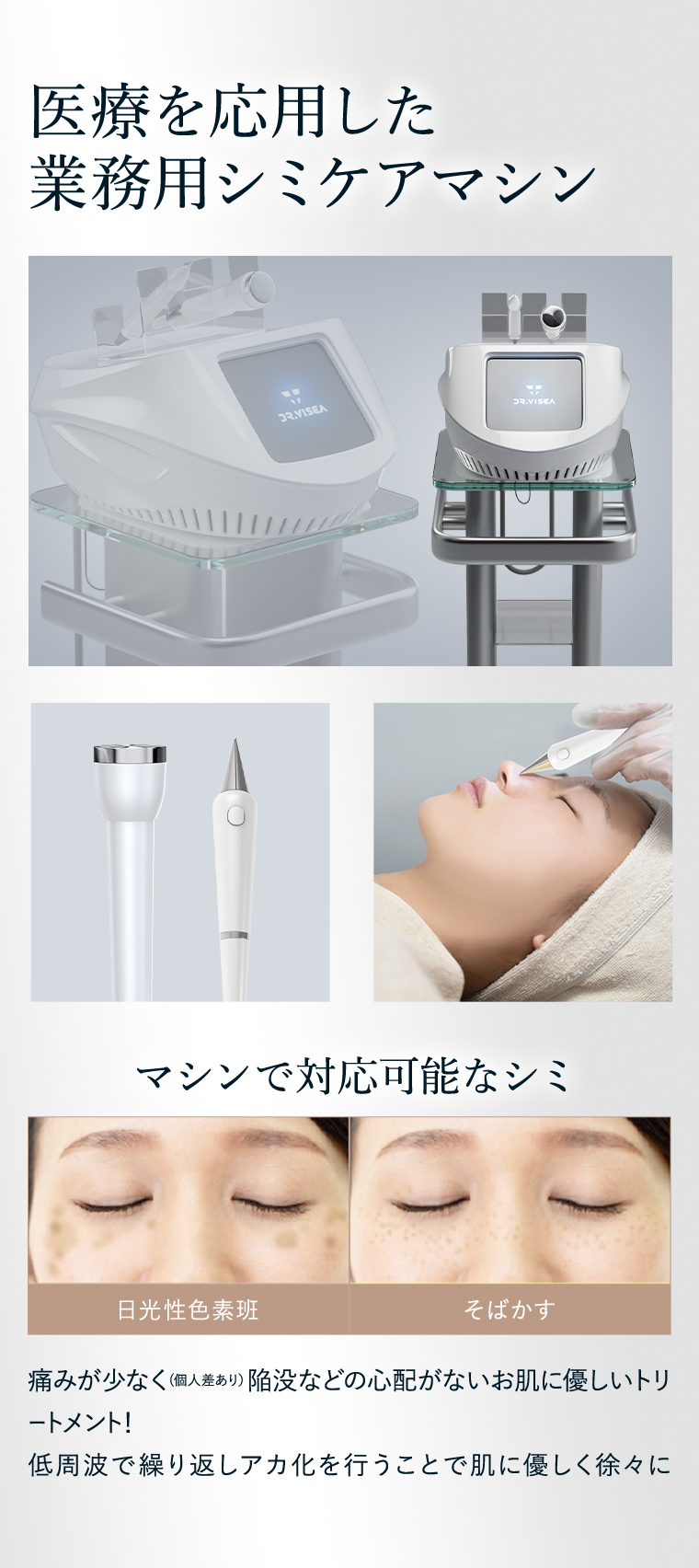 シミクライオポレーション｜株式会社Dr.Visea